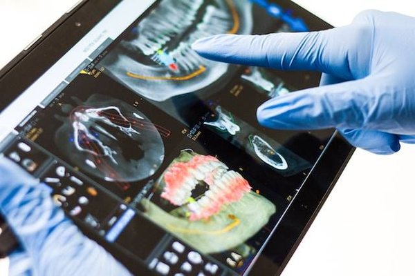 Tout savoir sur les types de garanties de mutuelle santé