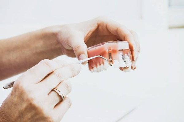 Où trouver des mutuelles santé spécialisées en dentaire en France ?