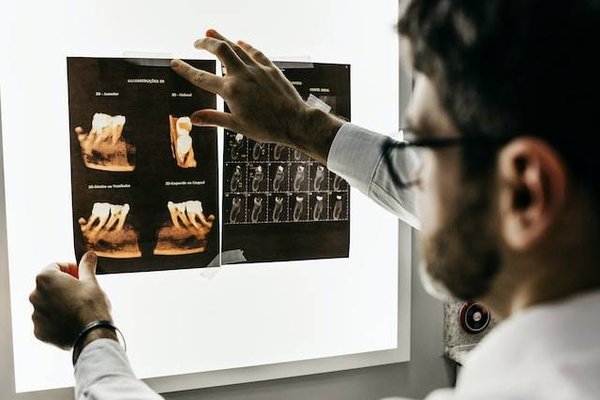 Quels sont les plafonds de remboursement dentaire avec sa mutuelle santé ?